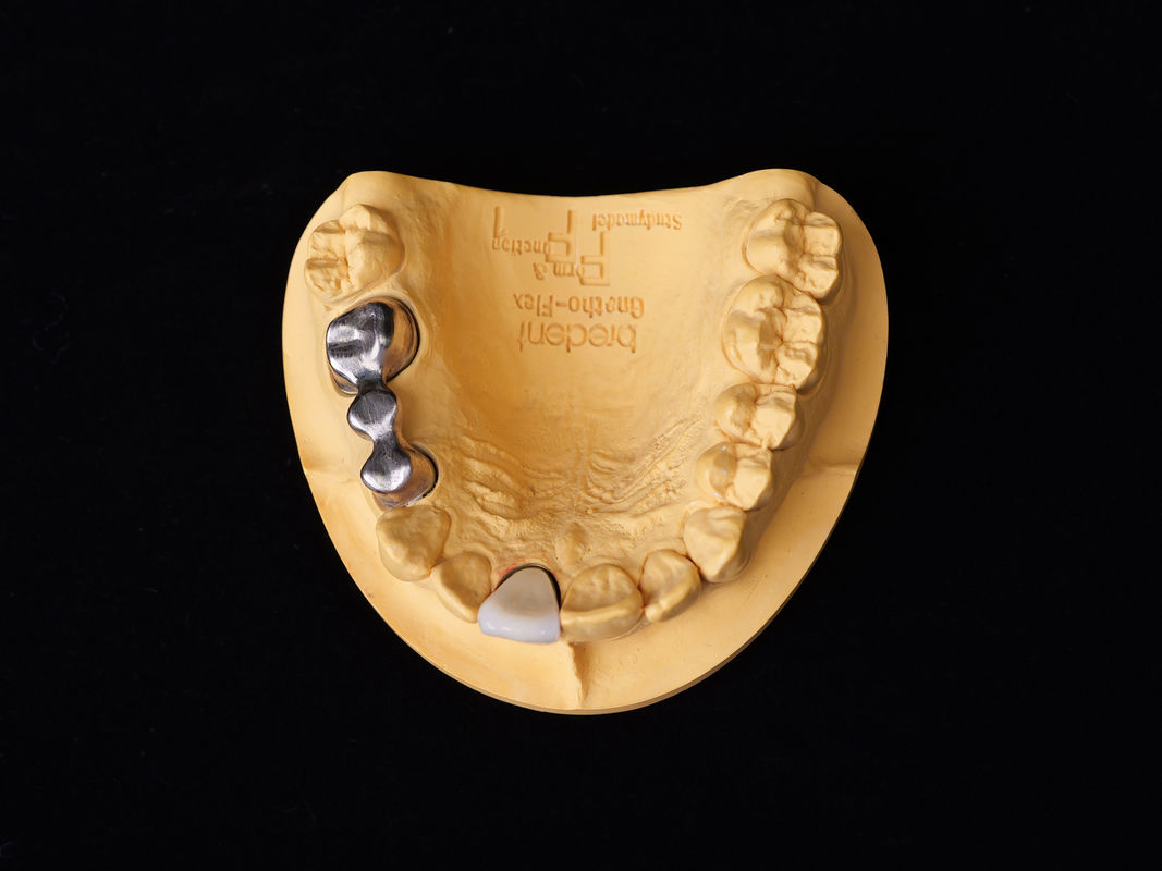 Audental 04 নোবেল অ্যালোয় সিলভার-প্যালাডিয়াম পোরসেলান অ্যালোয় হোয়াইট Pd53.3% দীর্ঘস্থায়ী দাঁত পুনরুদ্ধারের জন্য