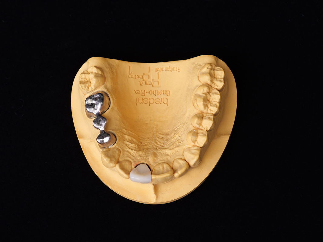 Audental 43 সিলভার-প্যালাডিয়াম পোরসিলিন খাদ সাদা Pd43% ন্যূনতম খাদ শক্তিশালী এবং নান্দনিক দাঁত পুনরুদ্ধারের জন্য