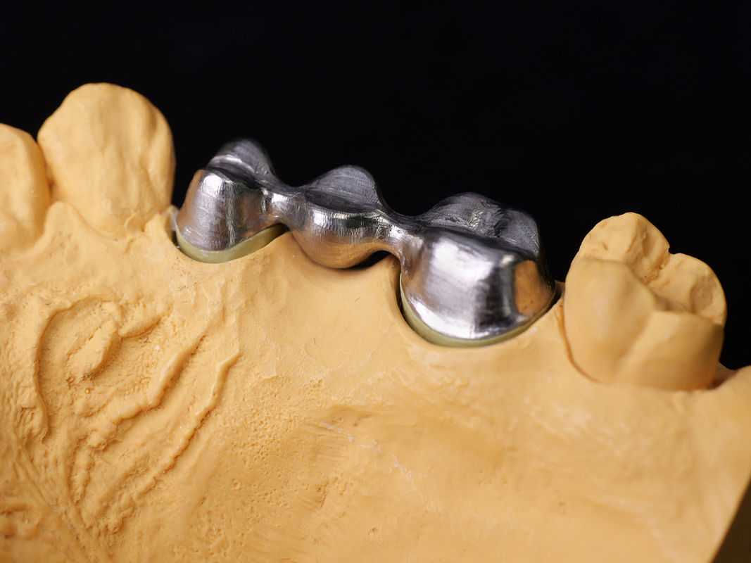 Audental 43 সিলভার-প্যালাডিয়াম পোরসিলিন খাদ সাদা Pd43% ন্যূনতম খাদ শক্তিশালী এবং নান্দনিক দাঁত পুনরুদ্ধারের জন্য